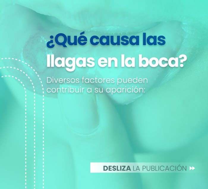 Llagas en la boca